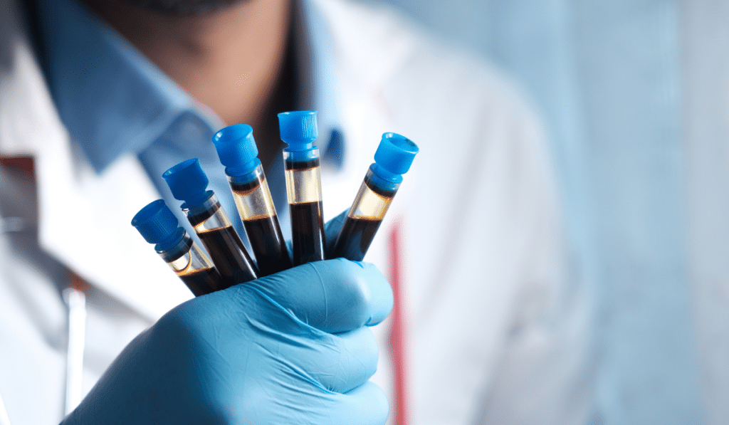 cord blood sample